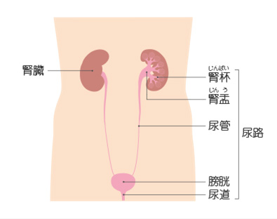 腎盂癌、尿管癌の図